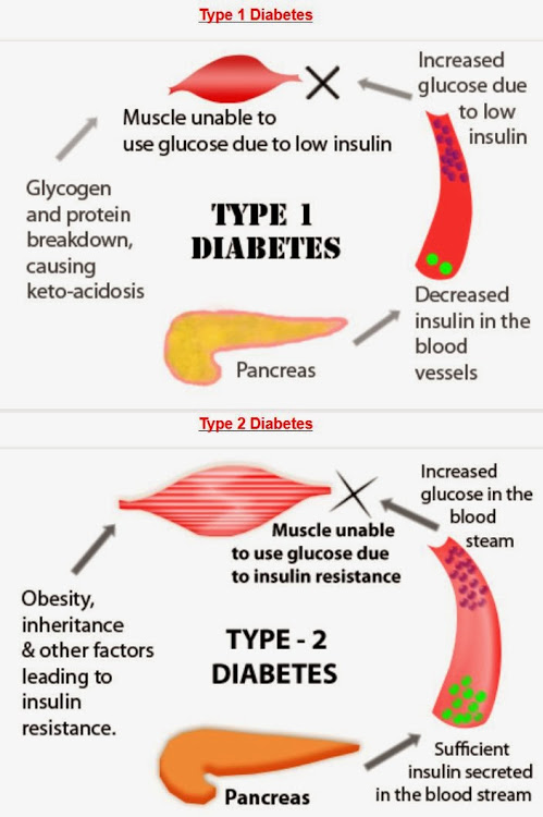 Diabetes Treatment in Pune