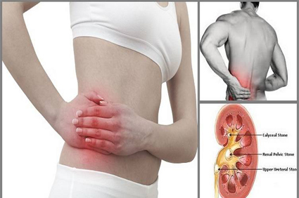 Kidney Stone Treatment in Pune